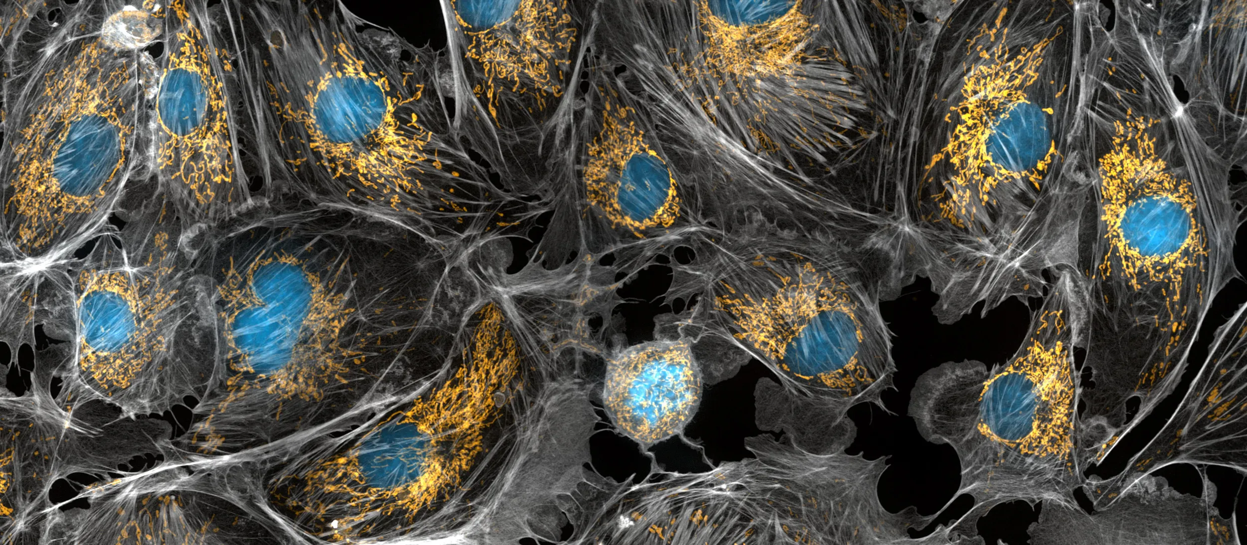 Mitochondria within living cells. Shown in yellow, with nuclei in blue and the cytoskeleton in gray.